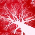 Studiuesit krijojnë mikrorobotë që notojnë në gjak për të parandaluar goditje në tru