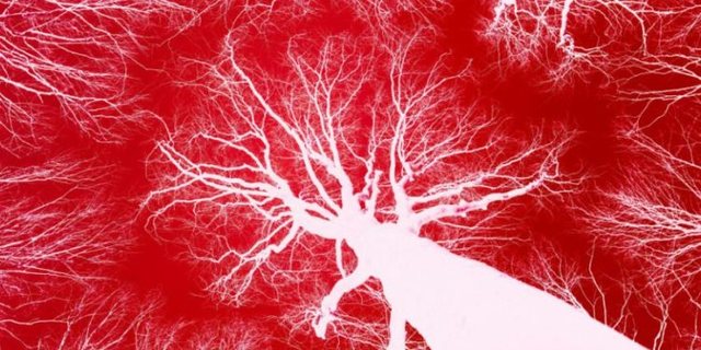 Studiuesit krijojnë mikrorobotë që notojnë në gjak për të parandaluar goditje në tru