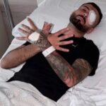 U plagos në sy gjatë protestës, Erjon Vishkulli reagon pas operacionit në Itali: Zoti do të sjellë lehtësim pas vështirësive